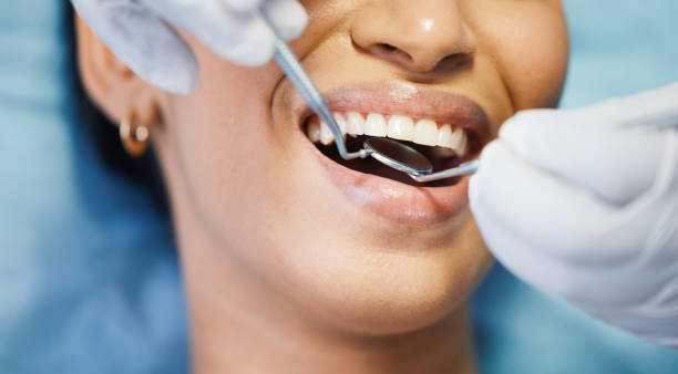 Best Emergency Treatment for Dental Infections or Abscesses in Morgantown, PA