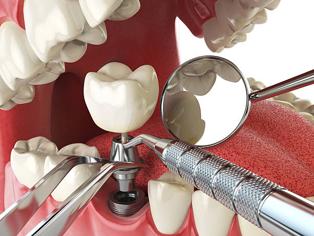 Best Emergency Gum Treatment in Morgantown, PA