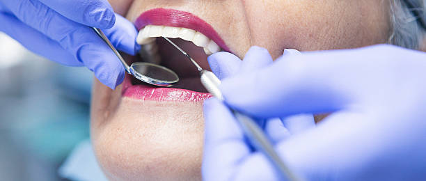 Best Urgent Care for Lost Fillings or Crowns in Morgantown, PA